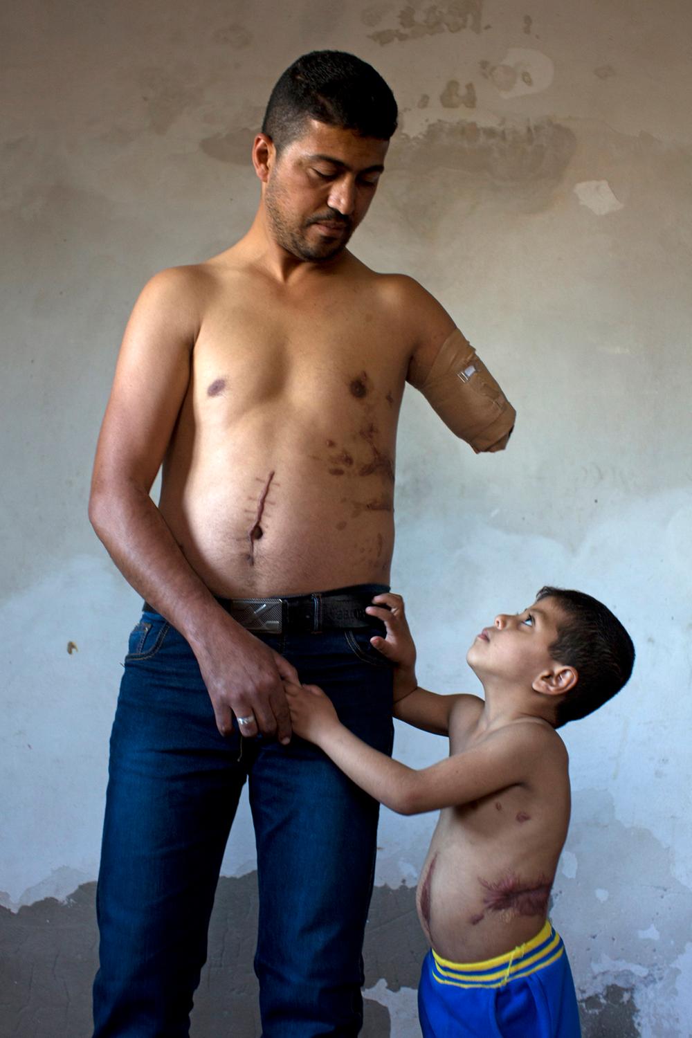 UNICEF-Foto des Jahres 2015